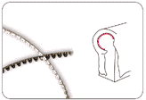 Alloy Plygrip